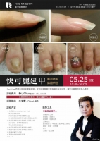 快可麗快速延甲